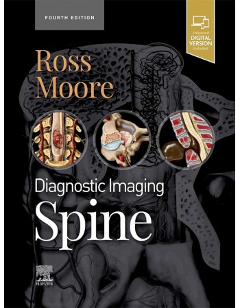 Diagnostic Imaging: Spine,...