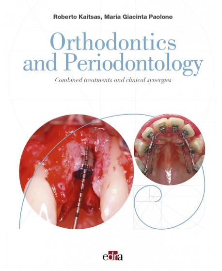 Orthodontics and Periodontology: Combined treatments and clinical synergies
