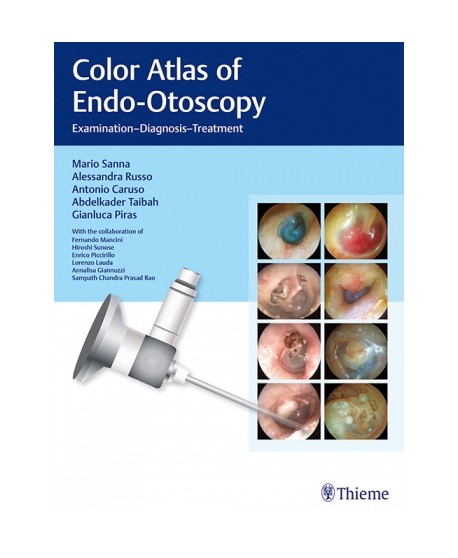 Sanna, Color Atlas of Endo-Otoscopy Examination-Diagnosis-Treatment
