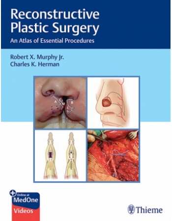 Reconstructive Plastic Surgery