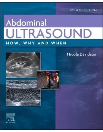 Abdominal Ultrasound, 4th...