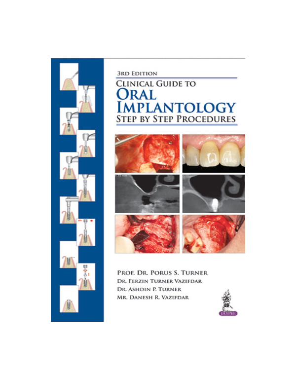 Clinical Guide to Oral Implantology Step by Step Procedures