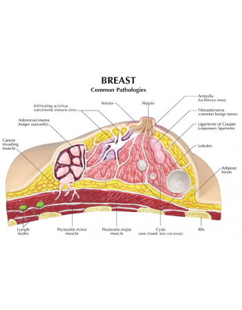Breast Cross-Section Model,...