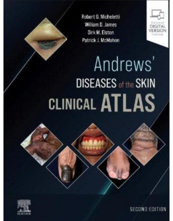 Andrews' Diseases of the...