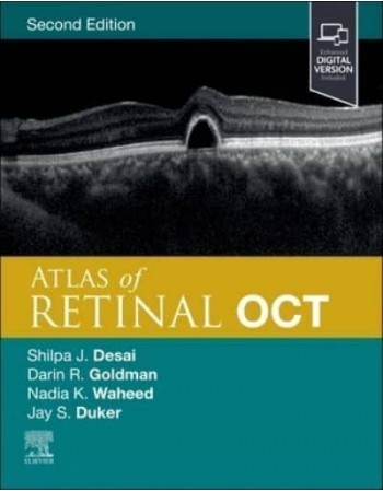 Atlas of Retinal OCT, 2nd...