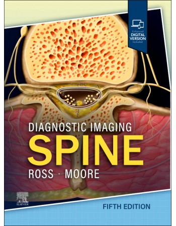 Diagnostic Imaging: Spine,...