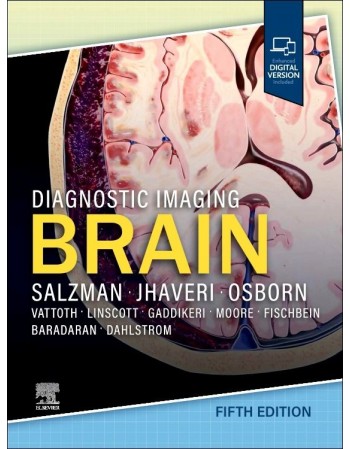 Diagnostic Imaging: Brain,...
