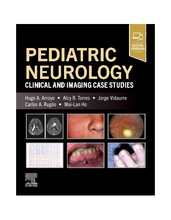 Pediatric Neurology...