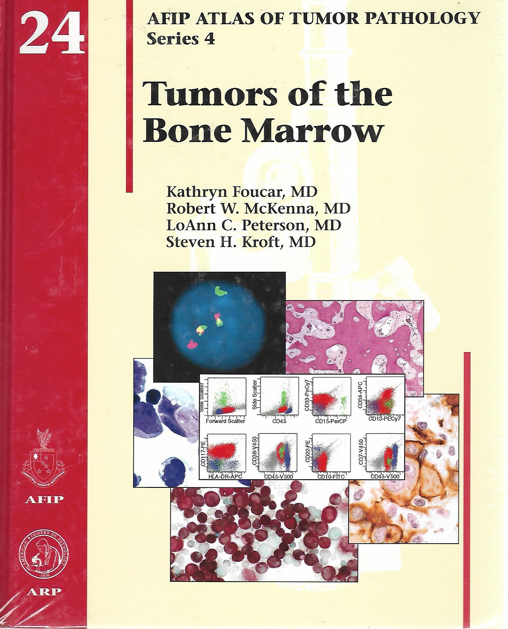 Tumors of the Bone Marrow