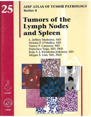 Tumors of the Lymph Nodes...