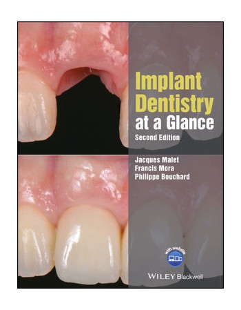 Implant Dentistry at a...
